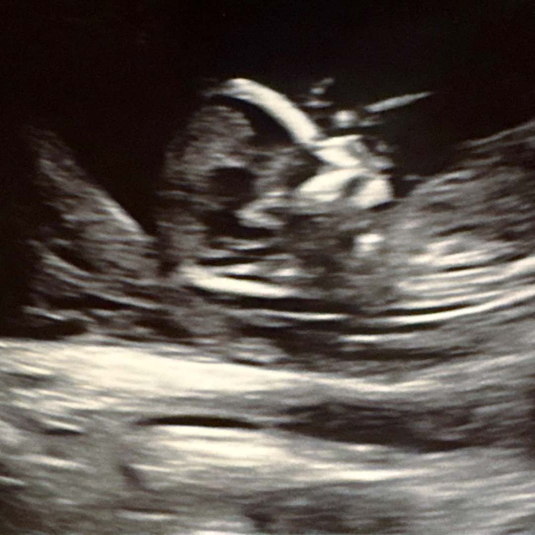 Photo shared by Jacqueline for their Babylist baby registry.