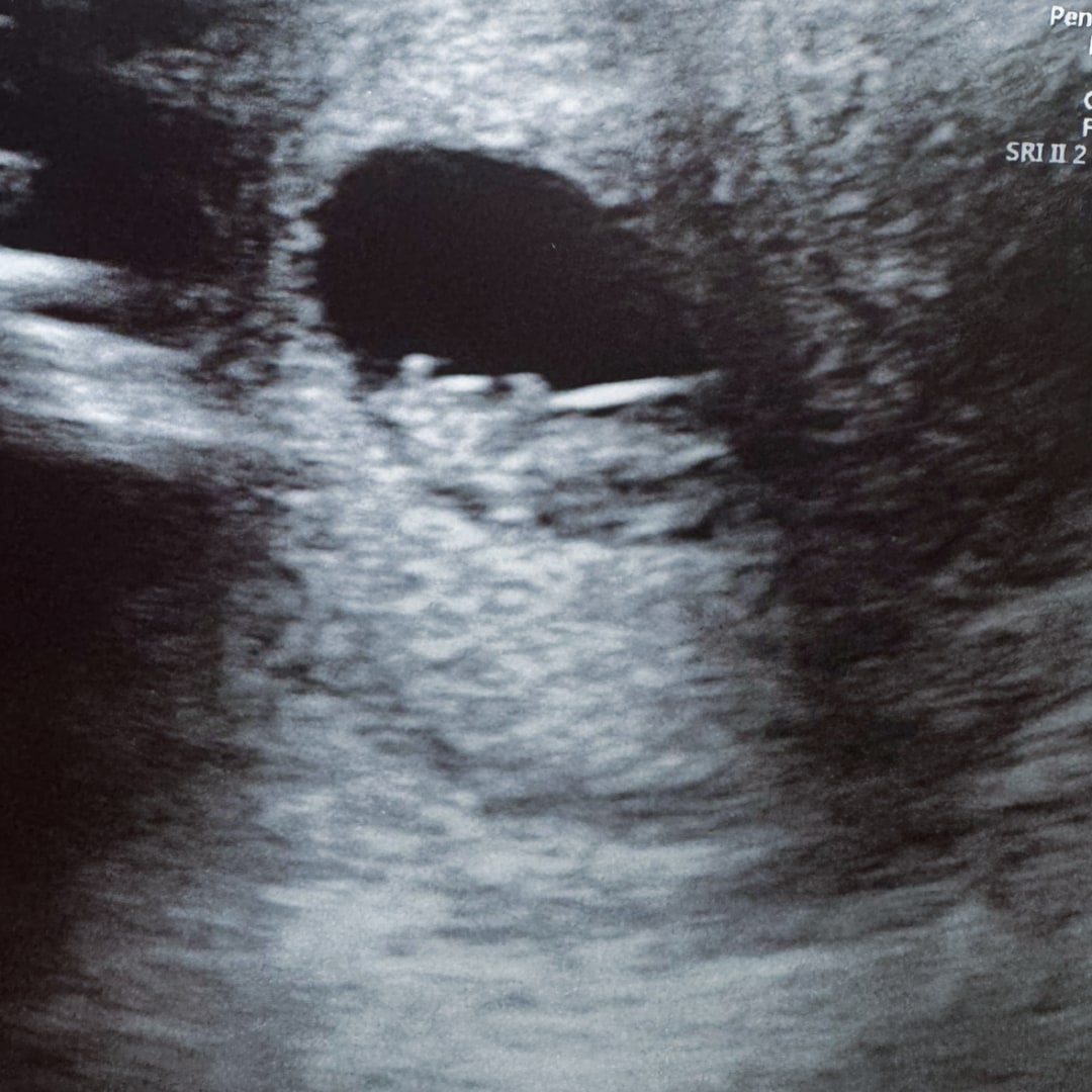 Photo shared by Cecily for their Babylist baby registry.