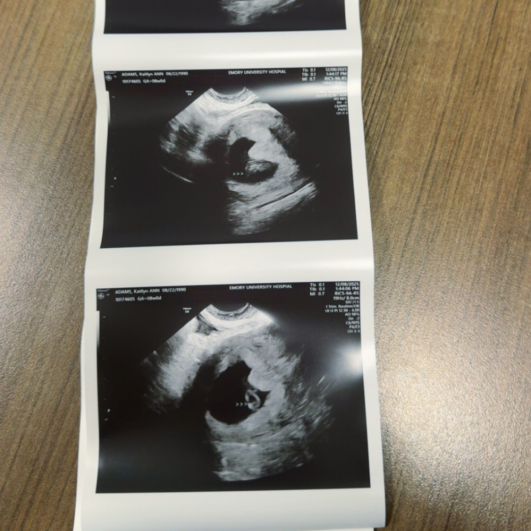 Photo shared by Kaitlyn for their Babylist baby registry.