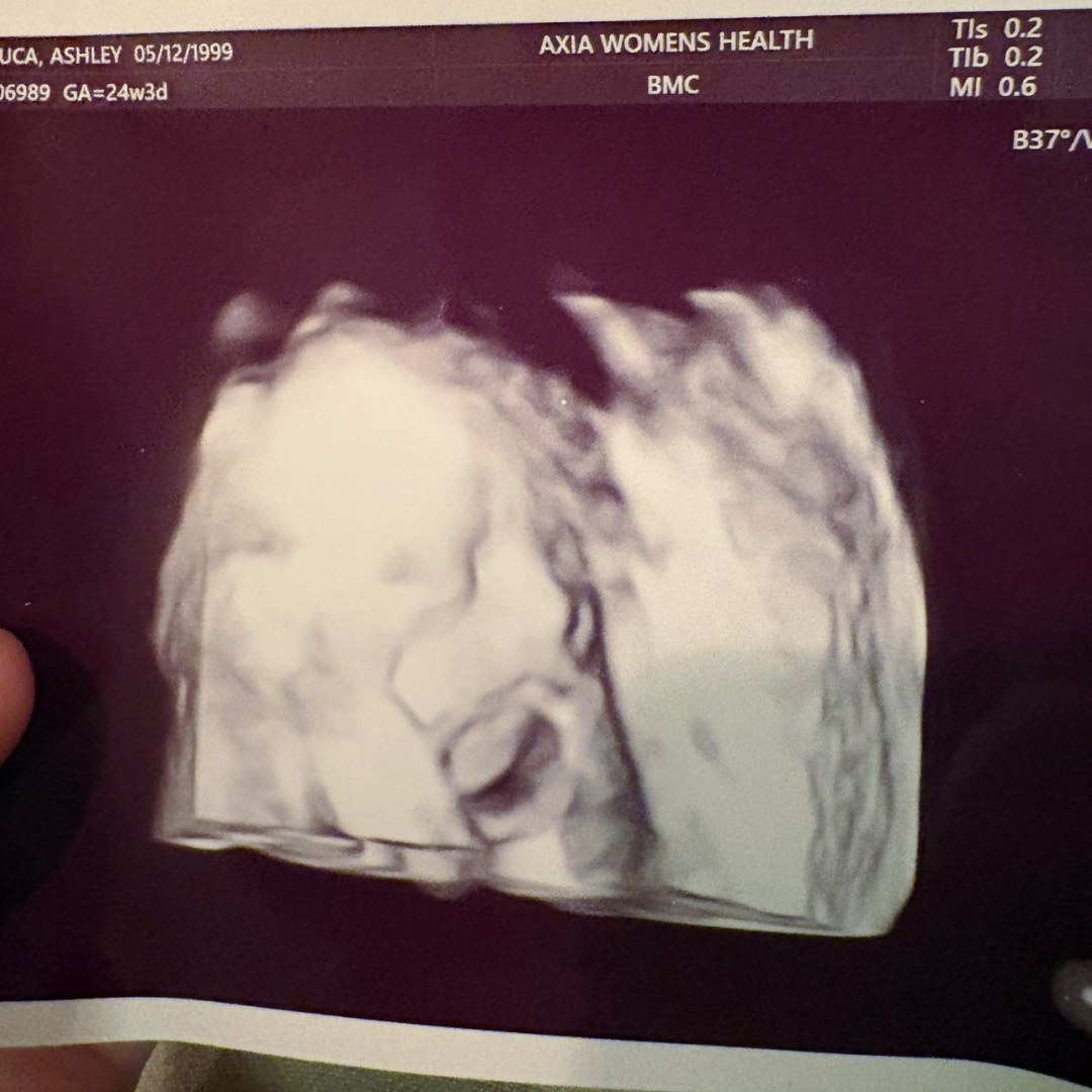 Photo shared by Ashley for their Babylist baby registry.