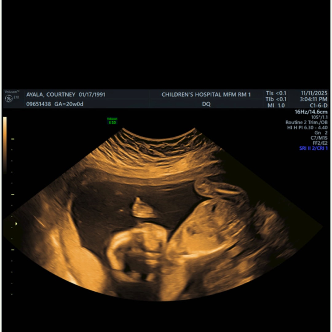 Photo shared by Courtney for their Babylist baby registry.