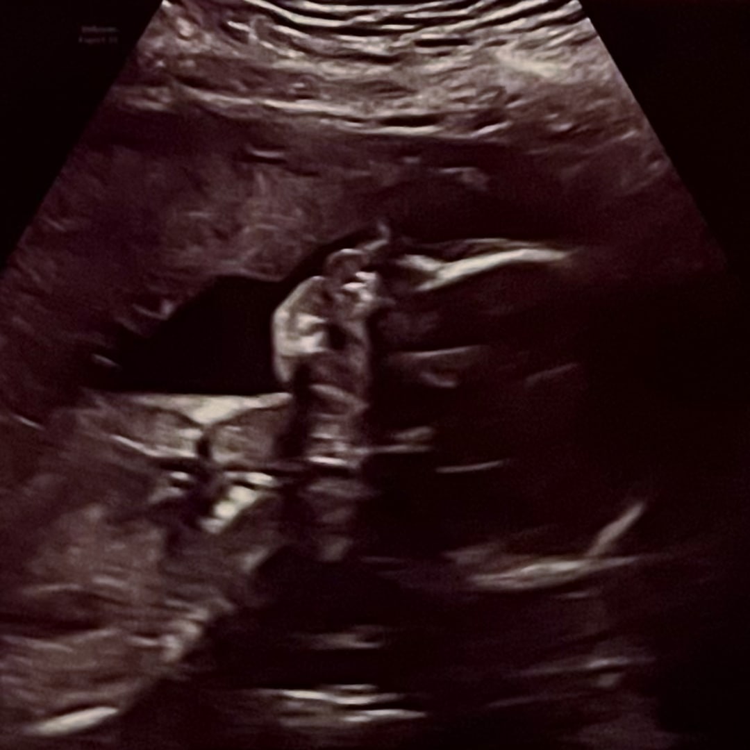 Photo shared by Christian for their Babylist baby registry.