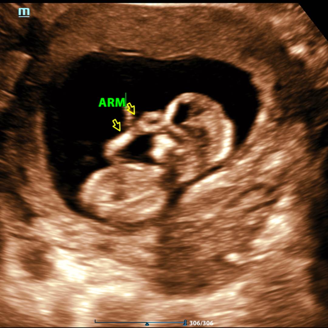 Photo shared by Ash for their Babylist baby registry.