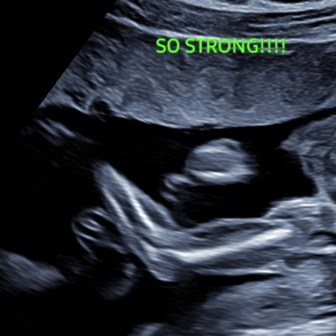 Photo shared by Caroline for their Babylist baby registry.