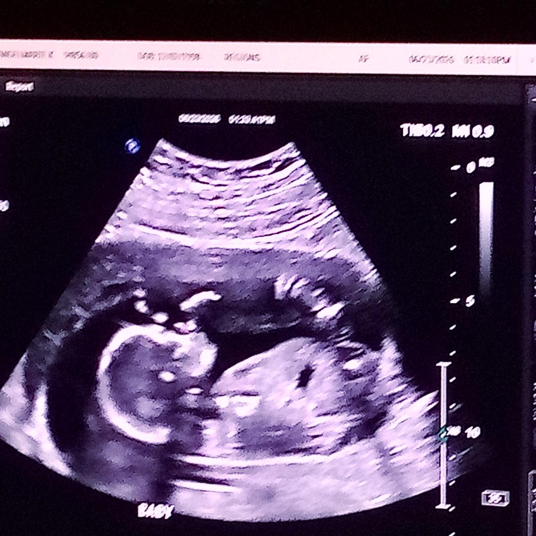 Photo shared by Angelmarie for their Babylist baby registry.