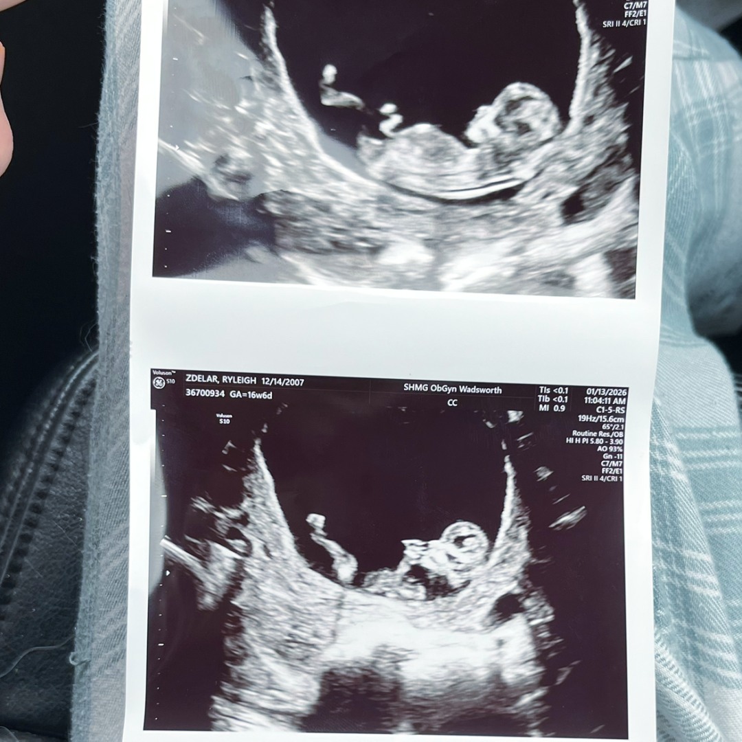 Photo shared by Ryleigh for their Babylist baby registry.