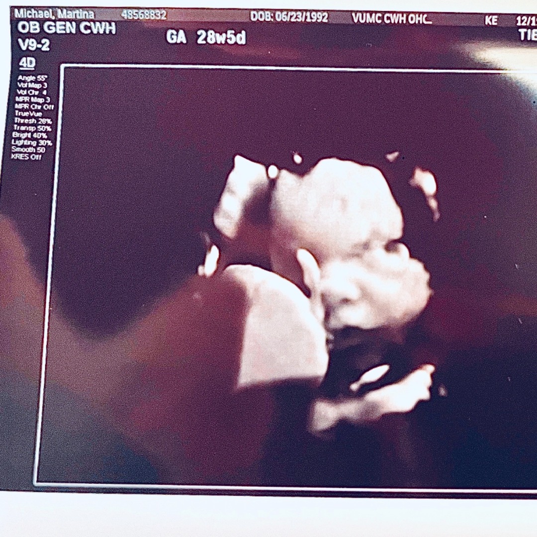 Photo shared by Martina for their Babylist baby registry.