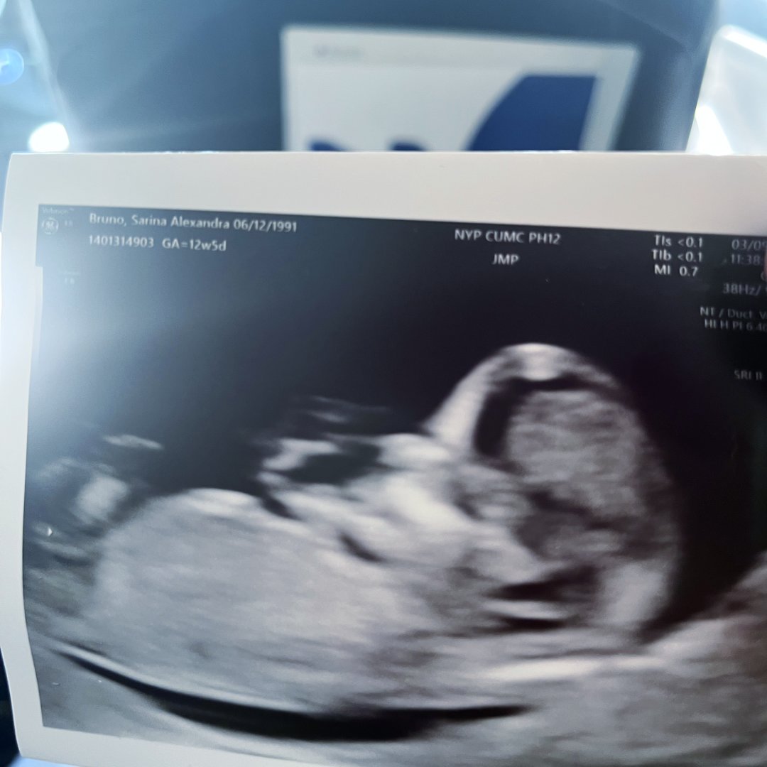 Photo shared by Sarina for their Babylist baby registry.