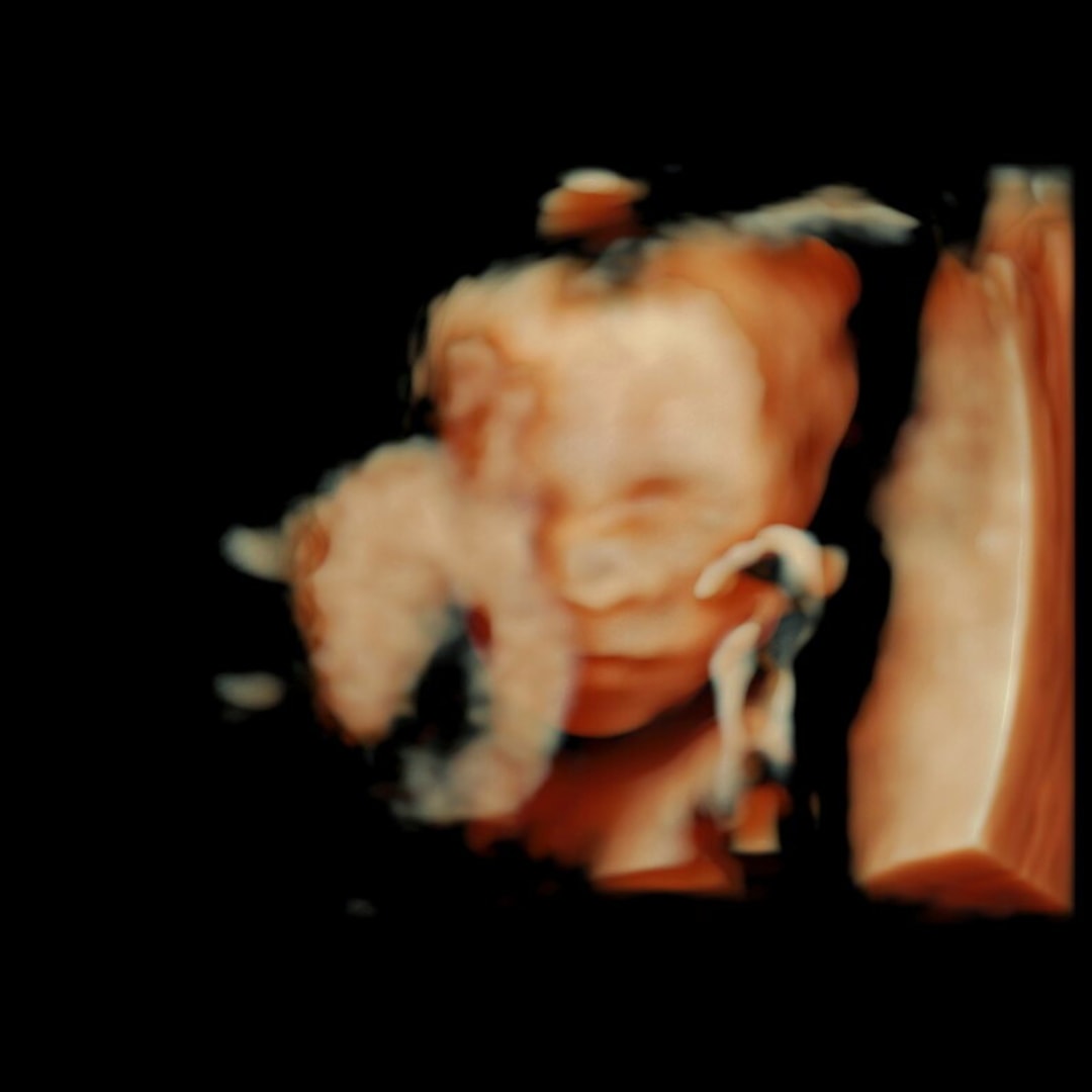 Photo shared by Emily for their Babylist baby registry.