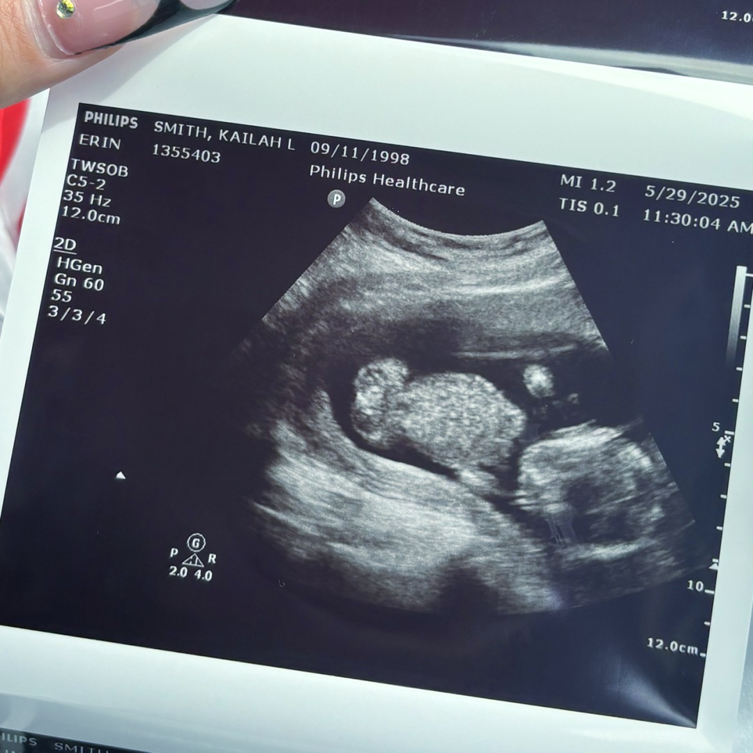 Photo shared by Kailah for their Babylist baby registry.