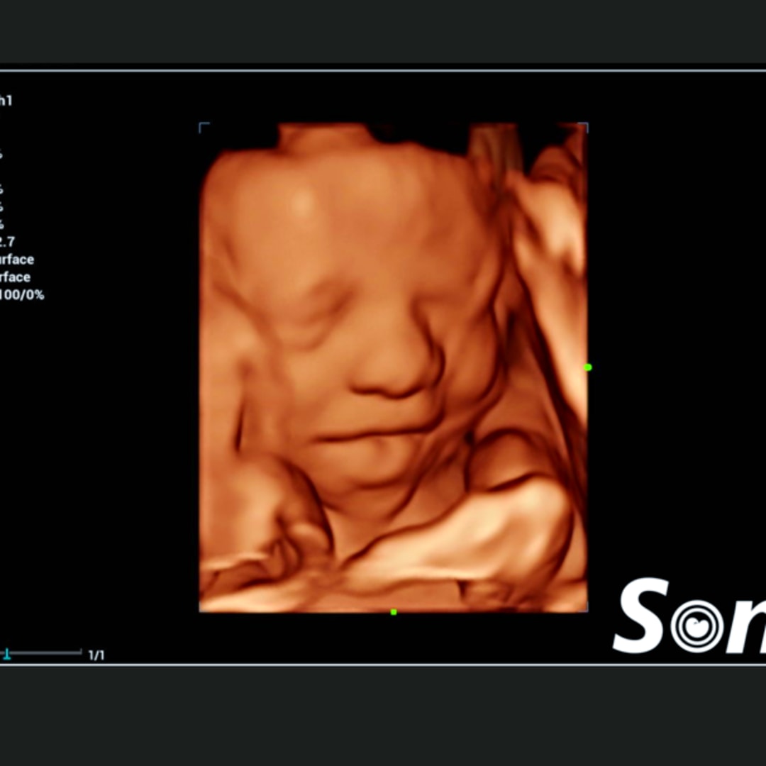 Photo shared by Jaydyn for their Babylist baby registry.