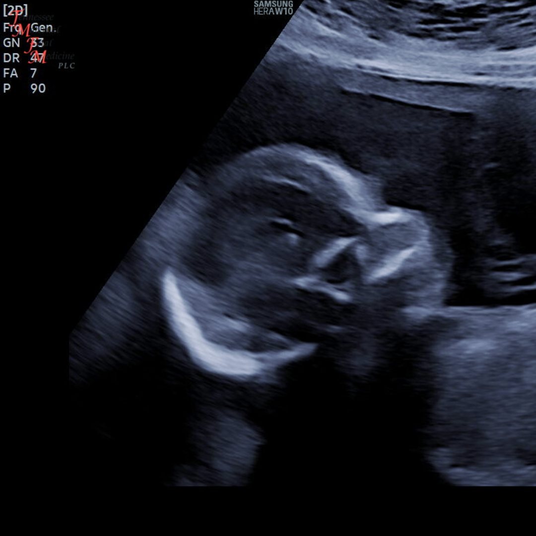 Photo shared by Mayla for their Babylist baby registry.