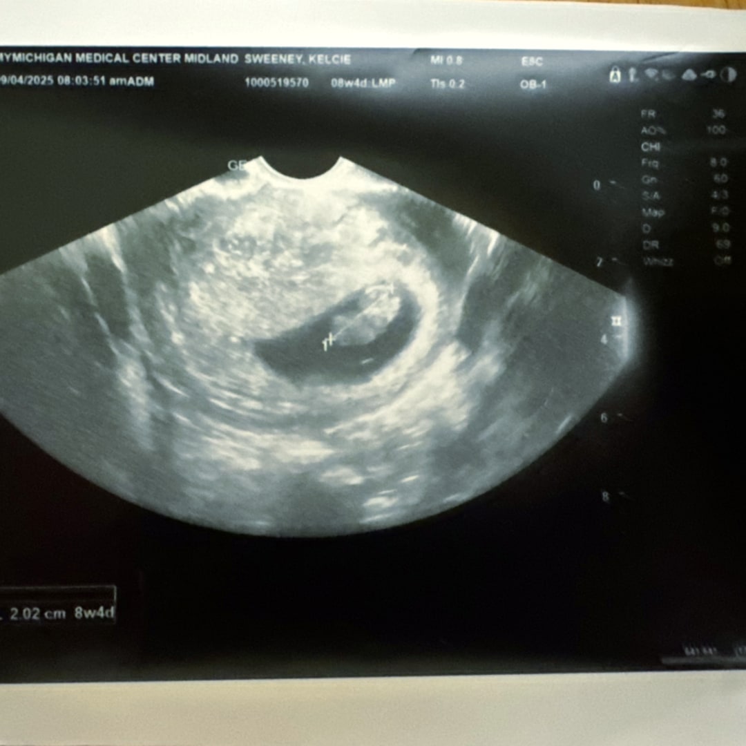 Photo shared by Kelcie for their Babylist baby registry.