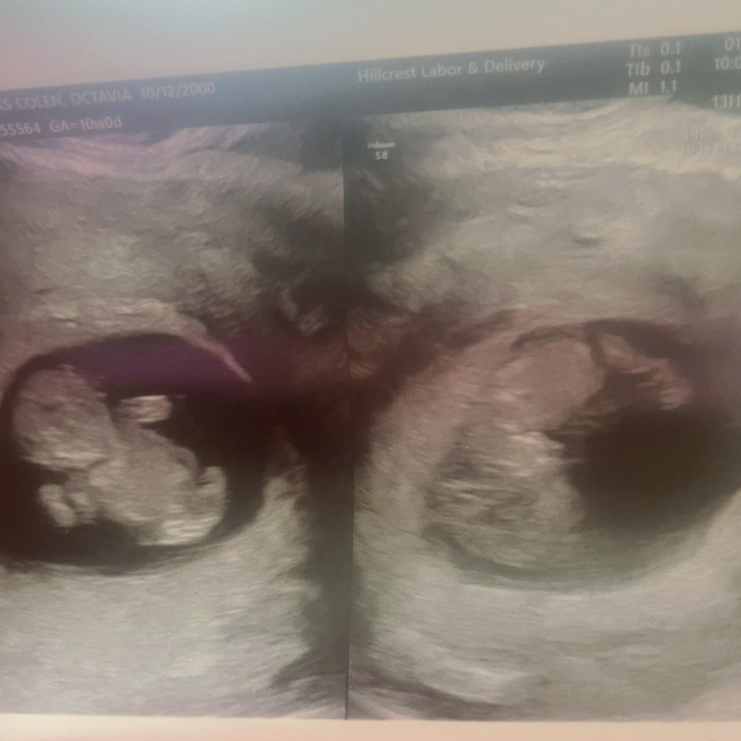 Photo shared by Octavia for their Babylist baby registry.