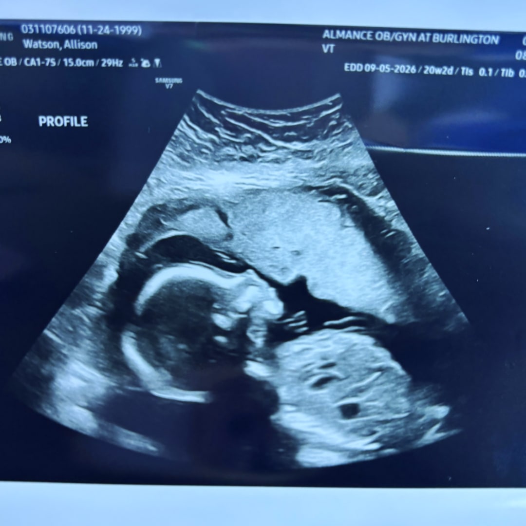 Photo shared by Allison for their Babylist baby registry.