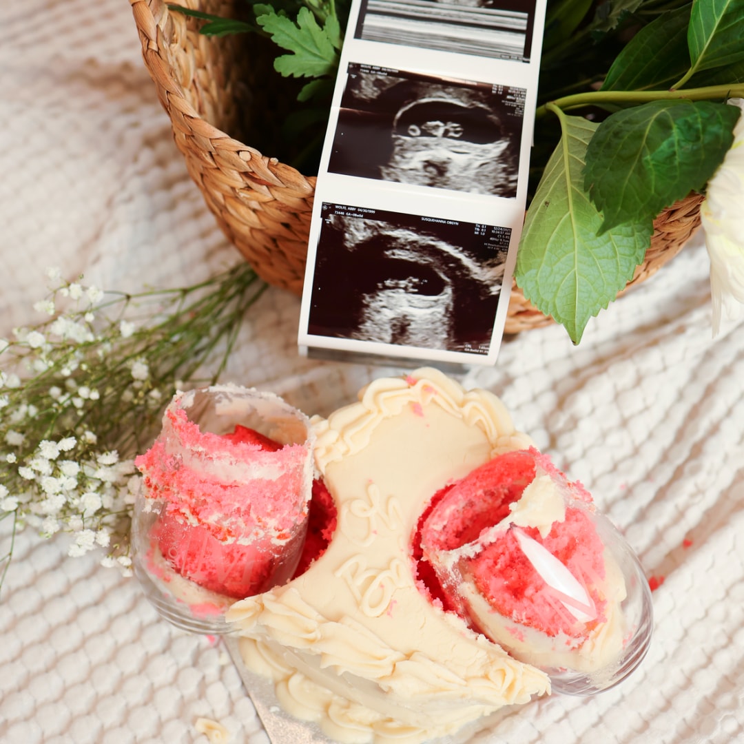 Photo shared by Abby for their Babylist baby registry.