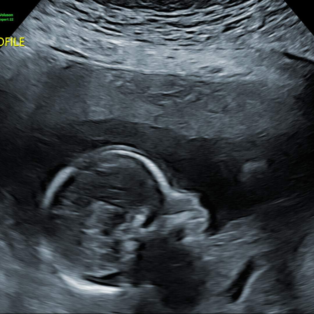 Photo shared by Brittany for their Babylist baby registry.