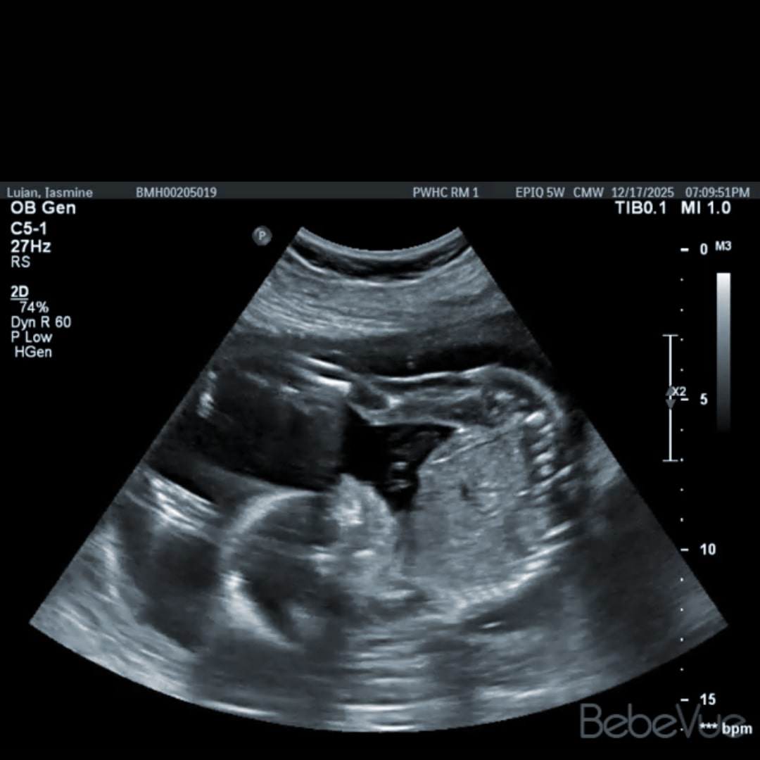 Photo shared by Jasmine for their Babylist baby registry.