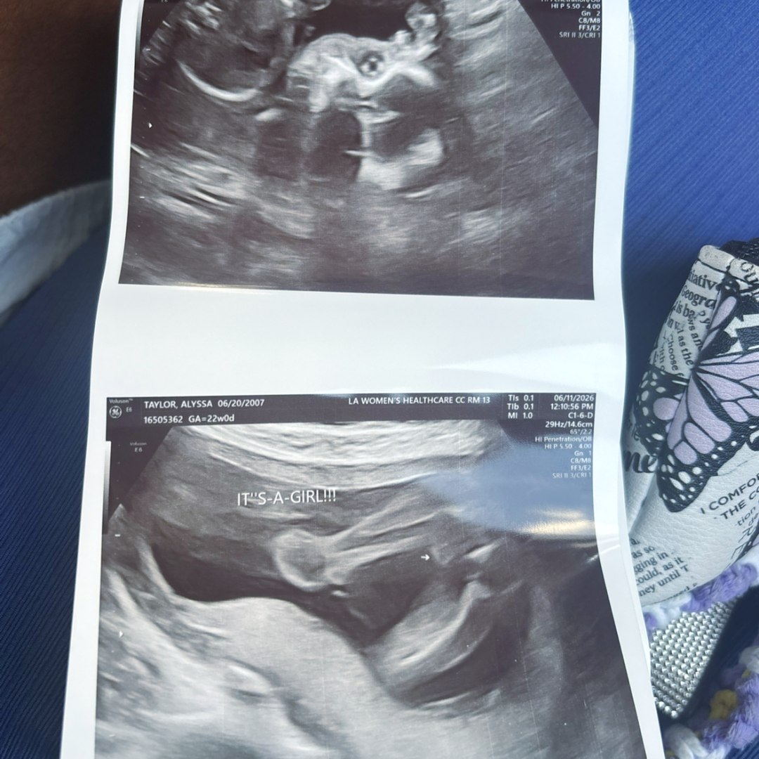 Photo shared by Alyssa for their Babylist baby registry.