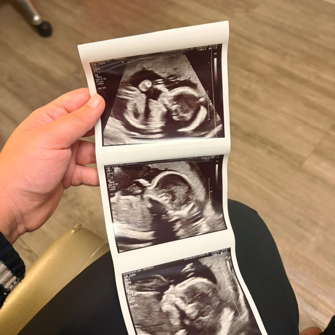 Photo shared by Radhika for their Babylist baby registry.