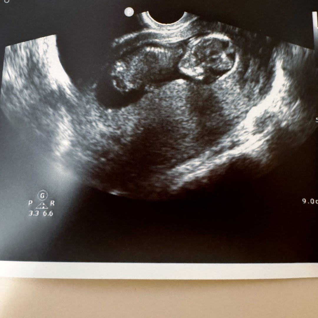 Photo shared by Alyssa for their Babylist baby registry.