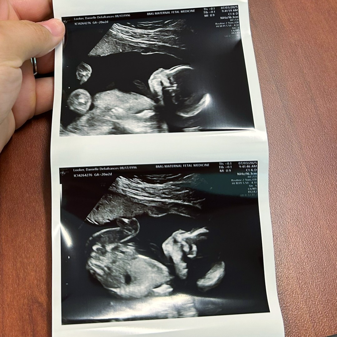 Photo shared by Austin + Danielle for their Babylist baby registry.