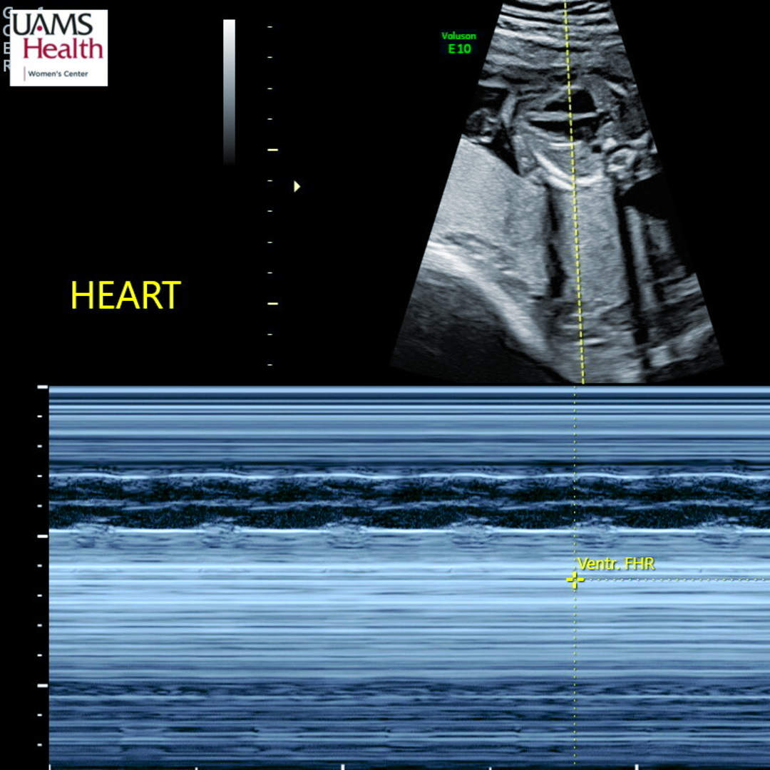 Photo shared by Lynda for their Babylist baby registry.