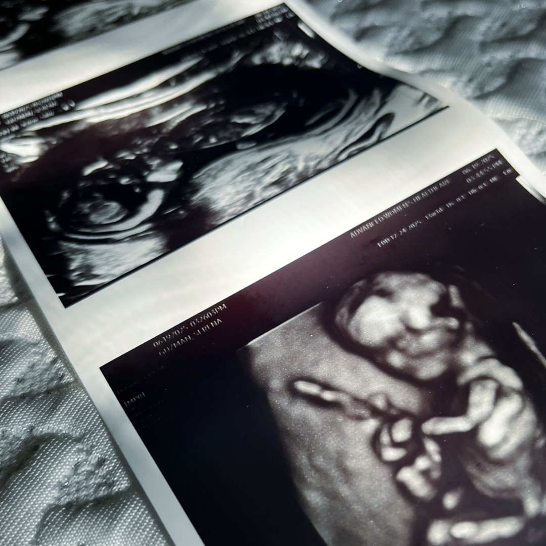 Photo shared by Serena for their Babylist baby registry.