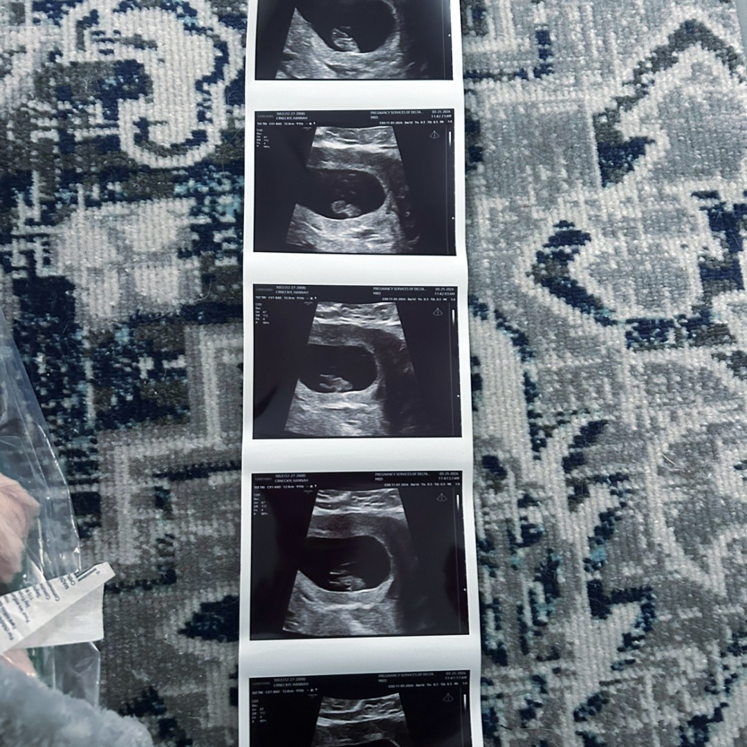 Photo shared by Hannah for their Babylist baby registry.