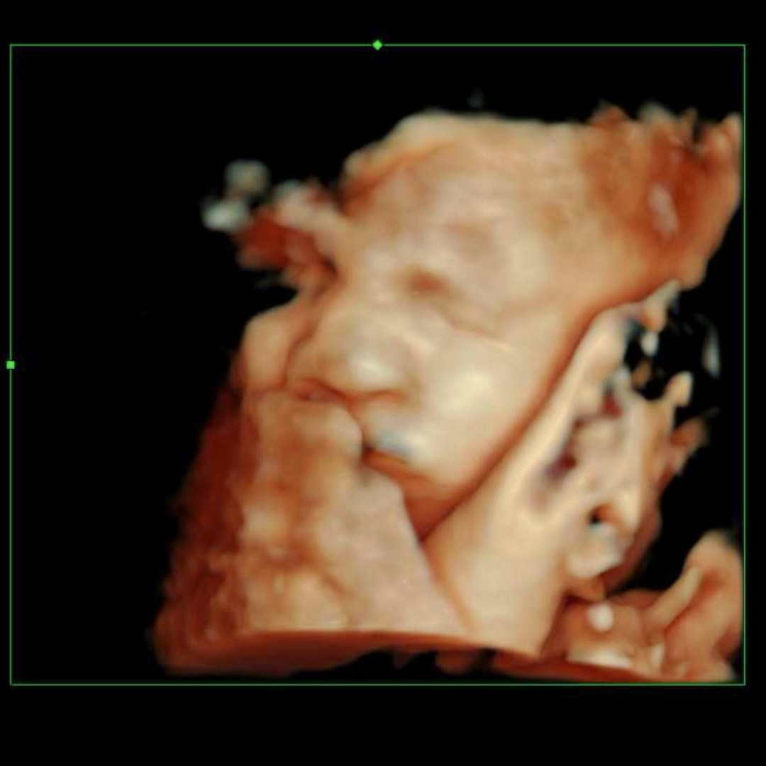 Photo shared by Amanda for their Babylist baby registry.