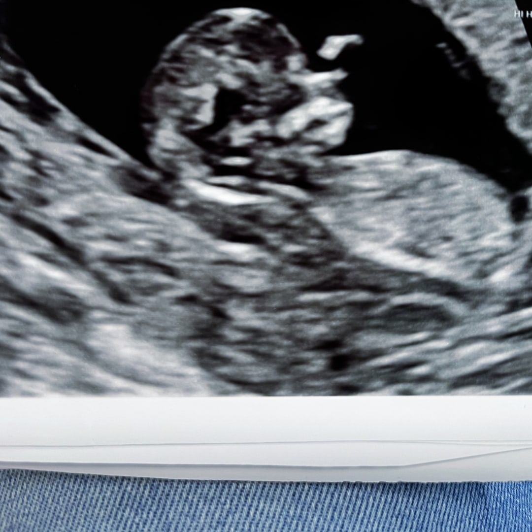 Photo shared by Aylissa for their Babylist baby registry.