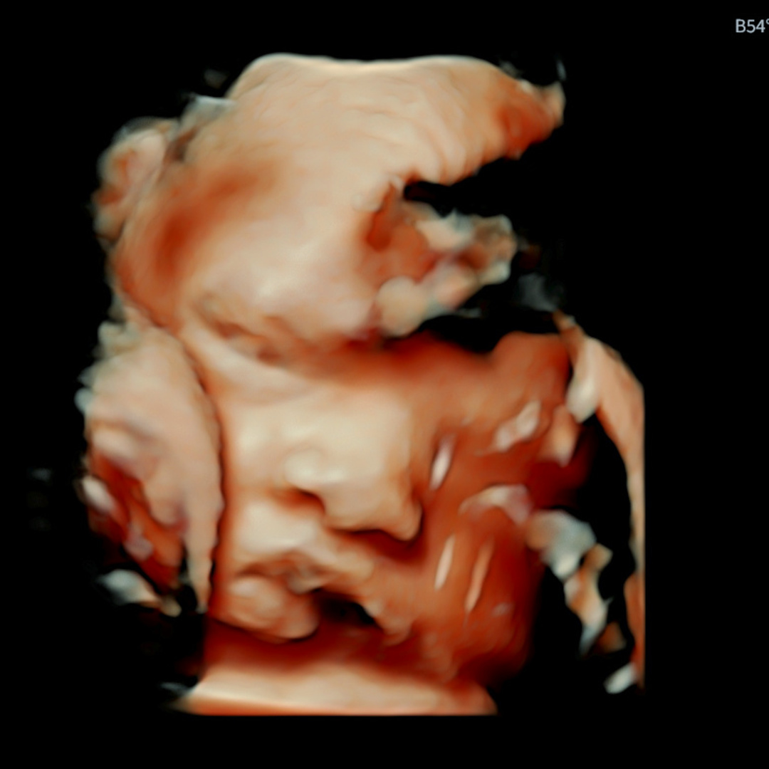 Photo shared by Aniya for their Babylist baby registry.