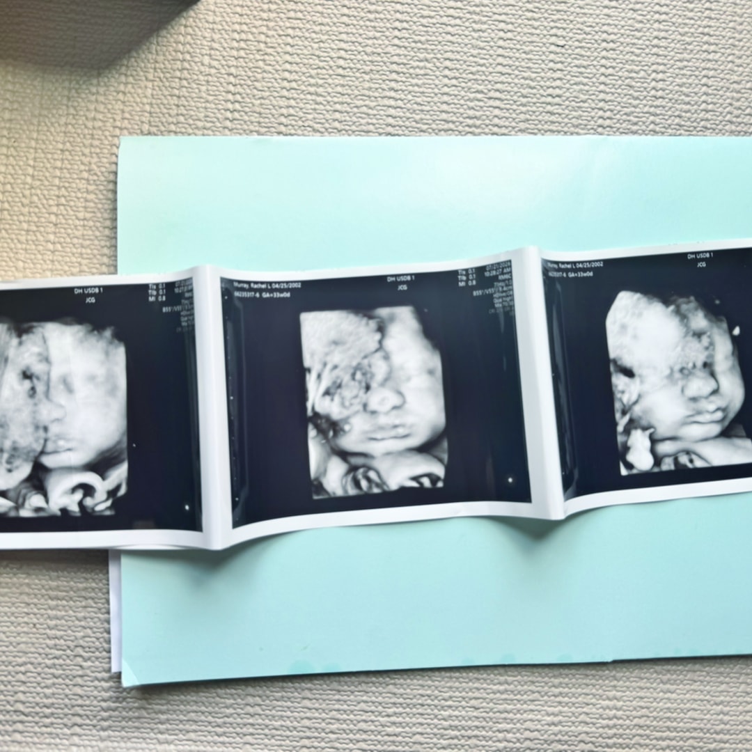 Photo shared by Rachel for their Babylist baby registry.