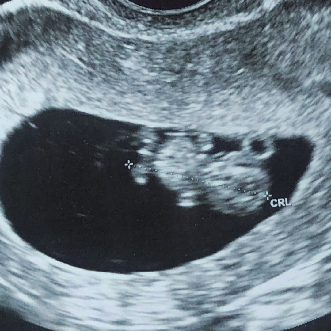 Photo shared by Brequela for their Babylist baby registry.
