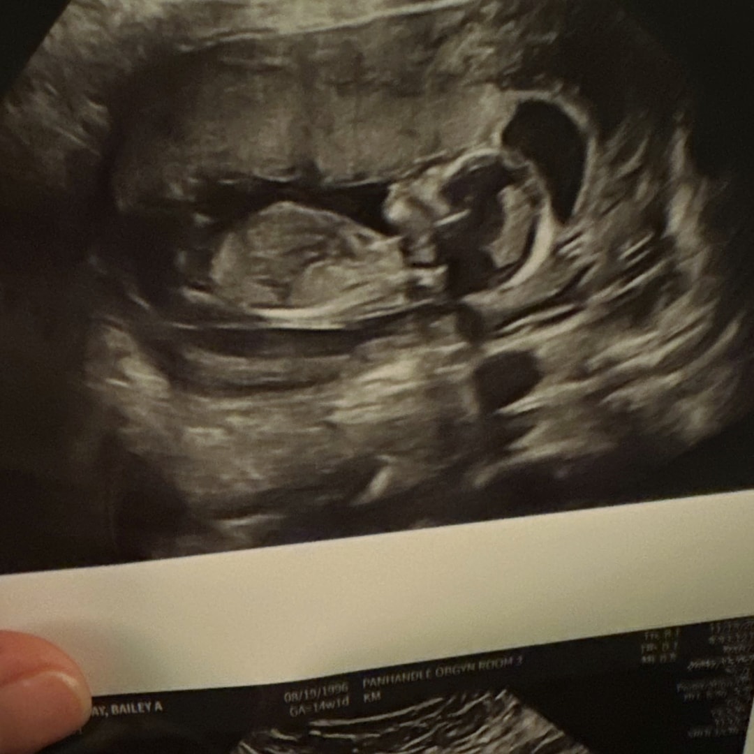 Photo shared by Bailey for their Babylist baby registry.