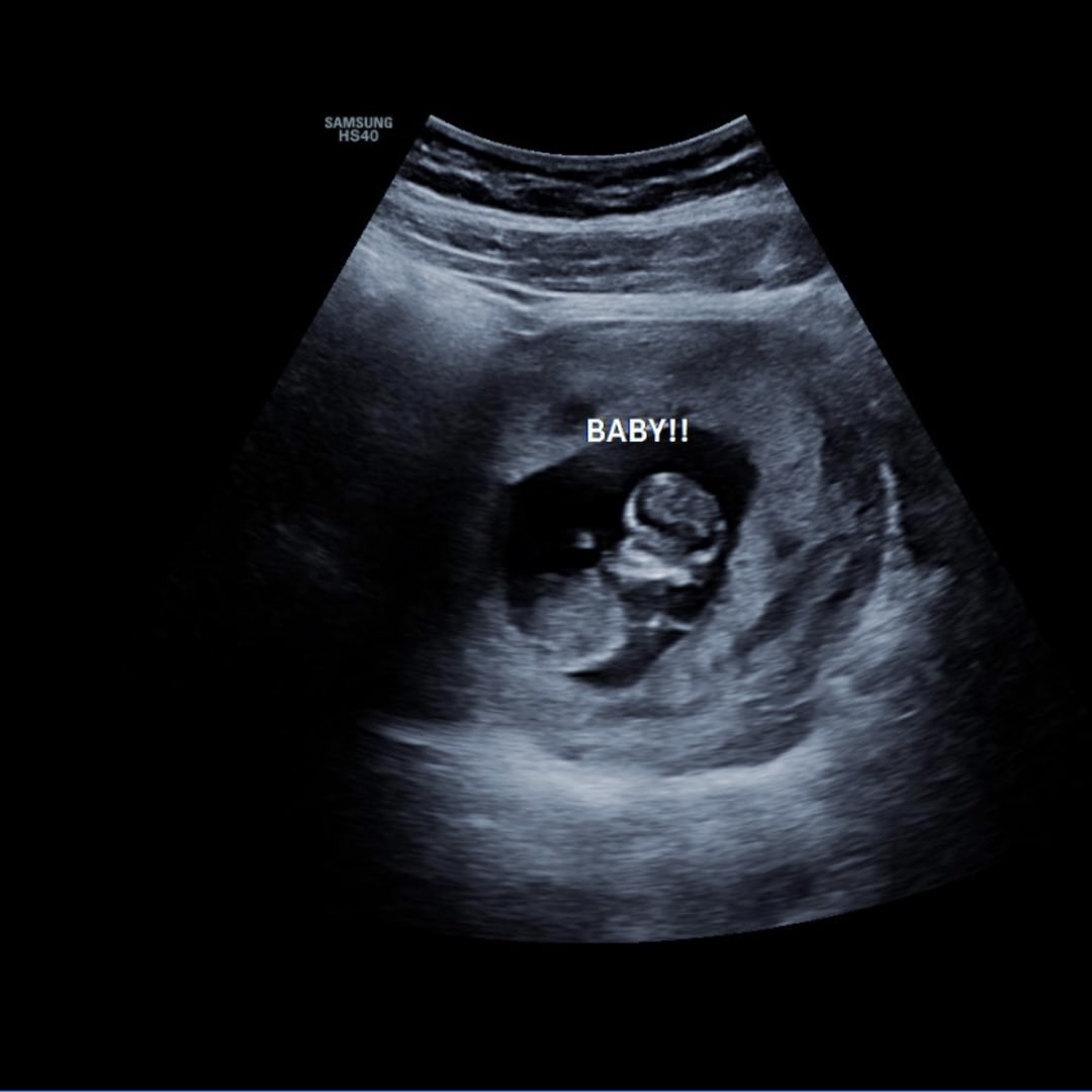 Photo shared by Kaley for their Babylist baby registry.