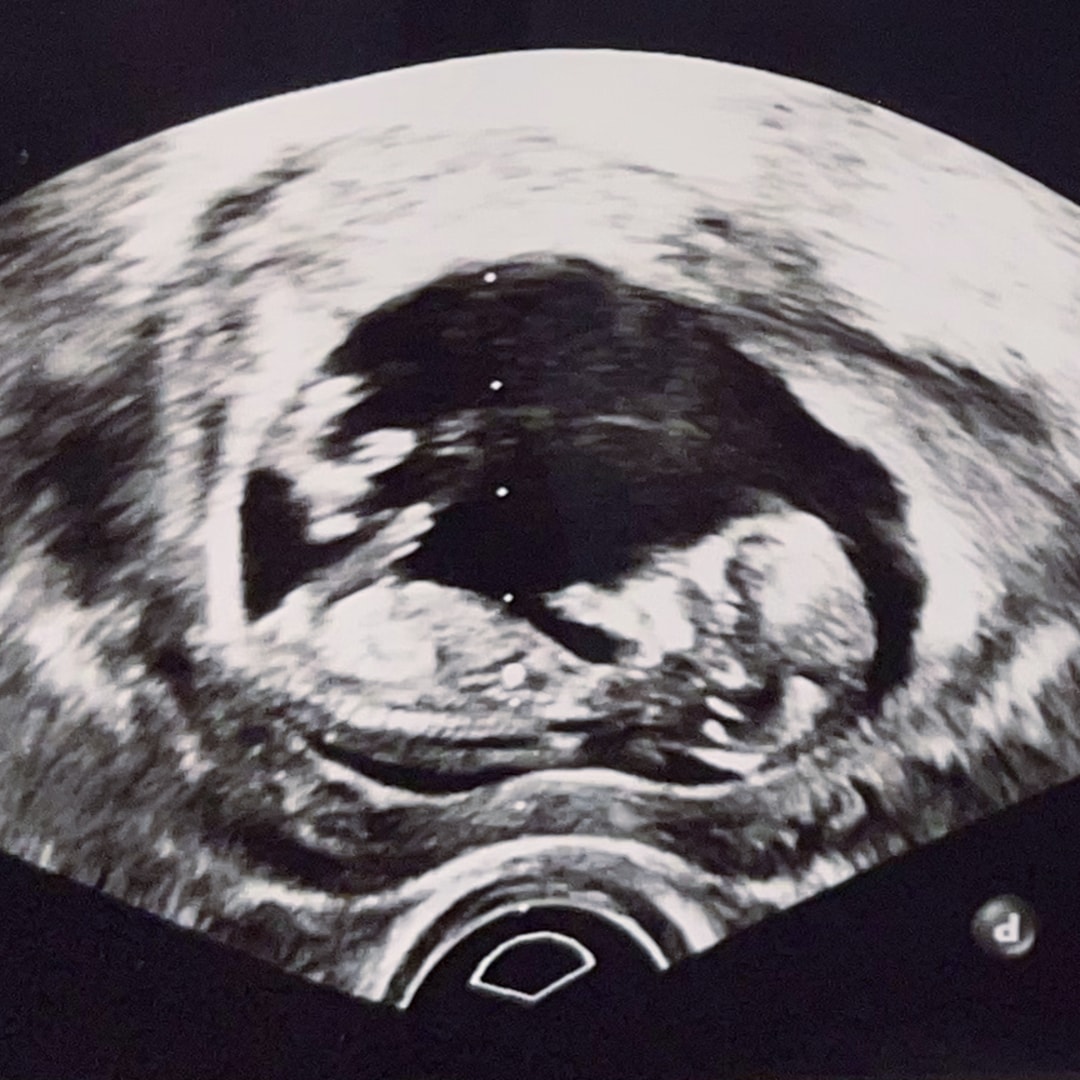 Photo shared by Brooklyn for their Babylist baby registry.