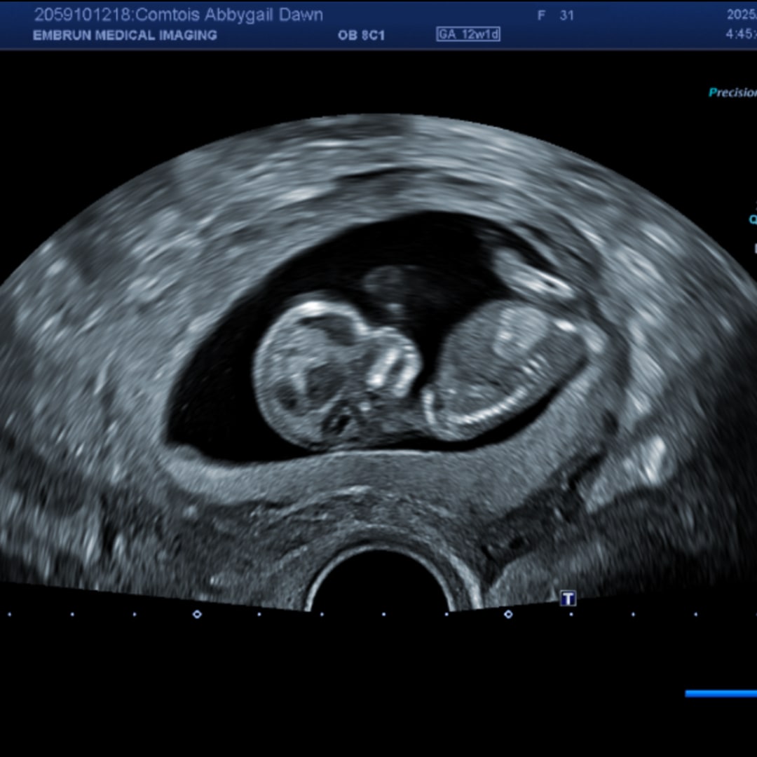 Photo shared by Abbygail for their Babylist baby registry.