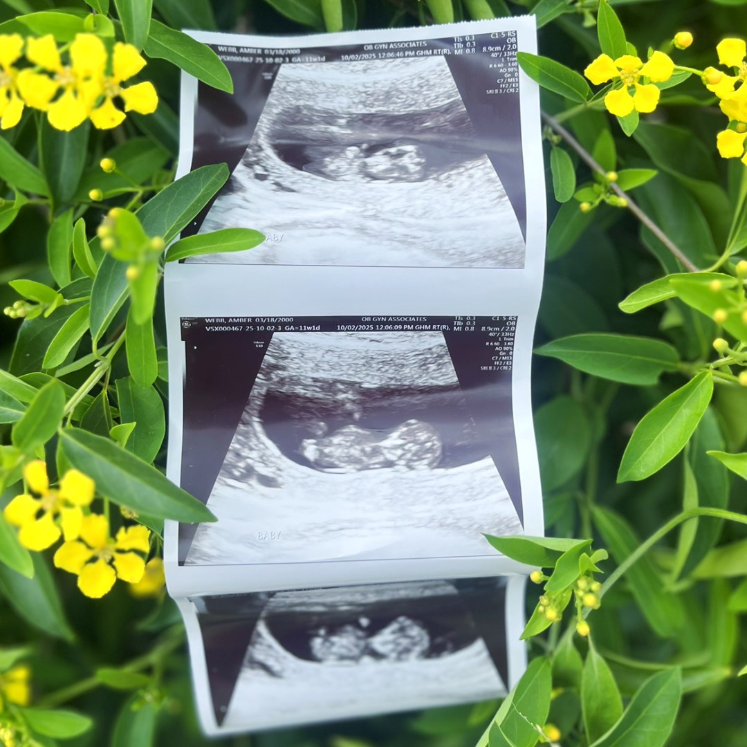 Photo shared by Amber for their Babylist baby registry.