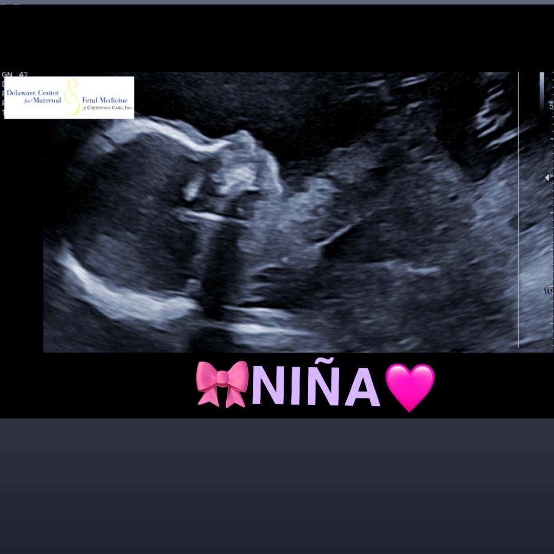 Photo shared by Dulce for their Babylist baby registry.