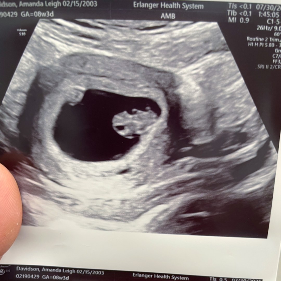 Photo shared by Amanda for their Babylist baby registry.