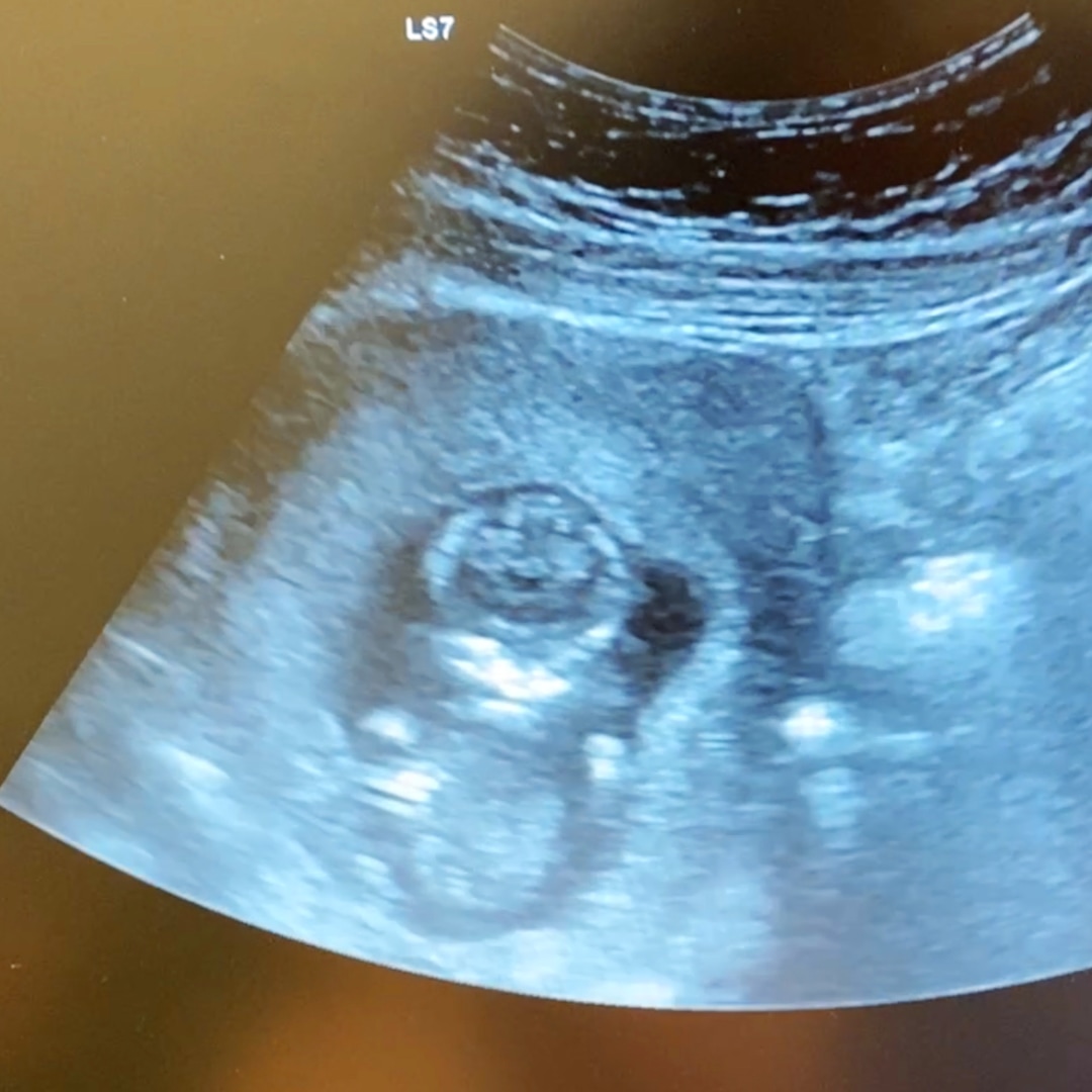 Photo shared by Emily for their Babylist baby registry.