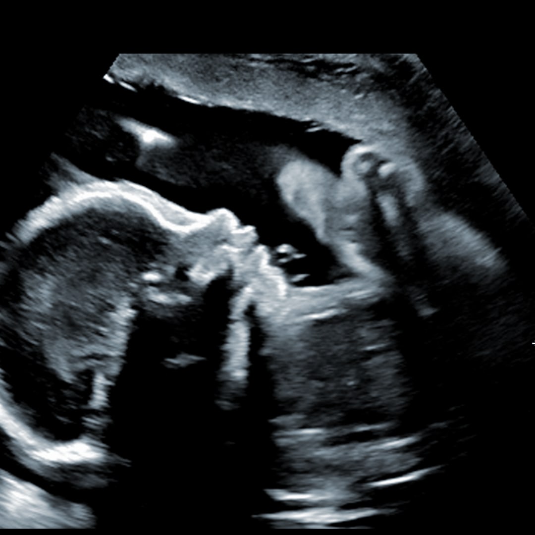 Photo shared by Chasity for their Babylist baby registry.