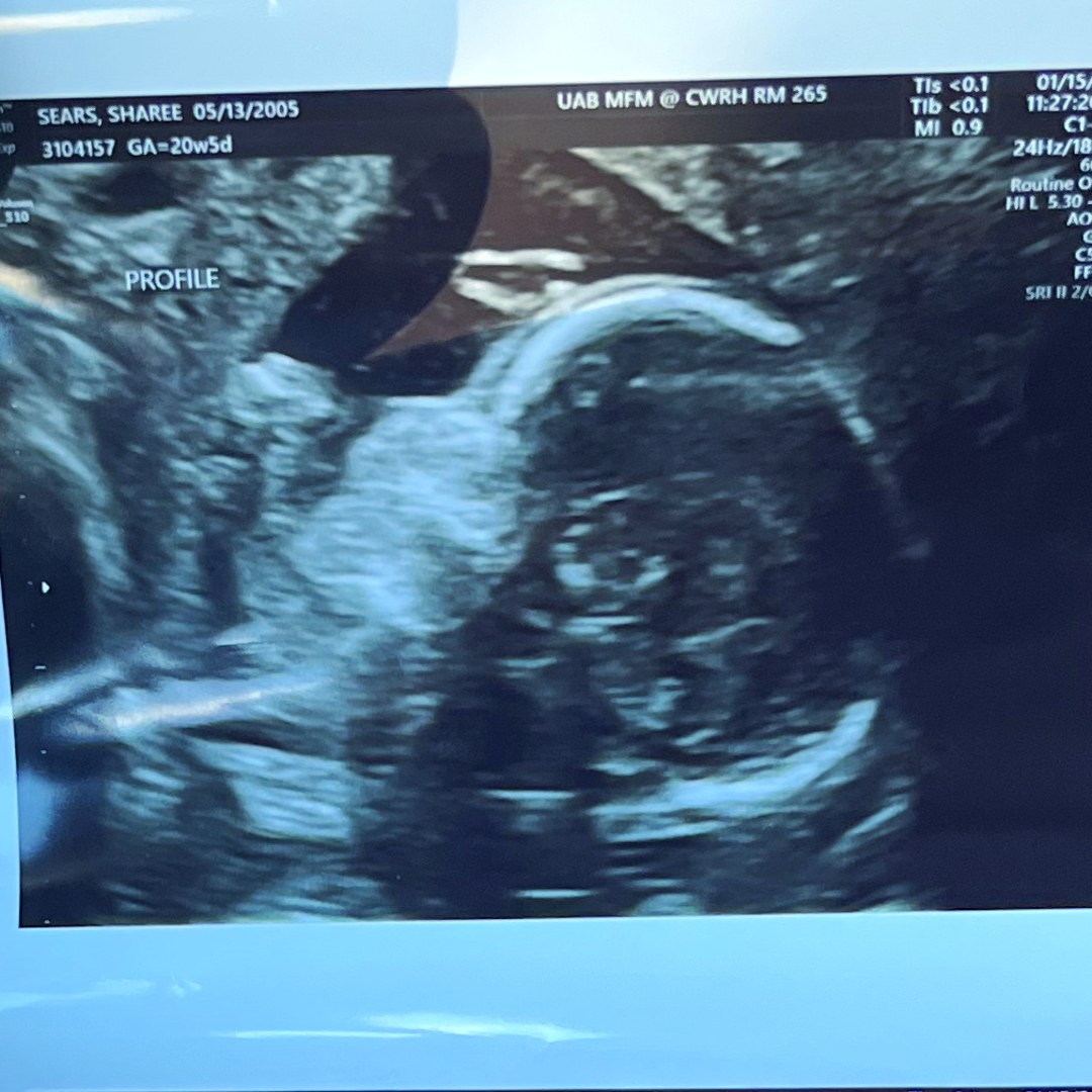 Photo shared by Sharee for their Babylist baby registry.