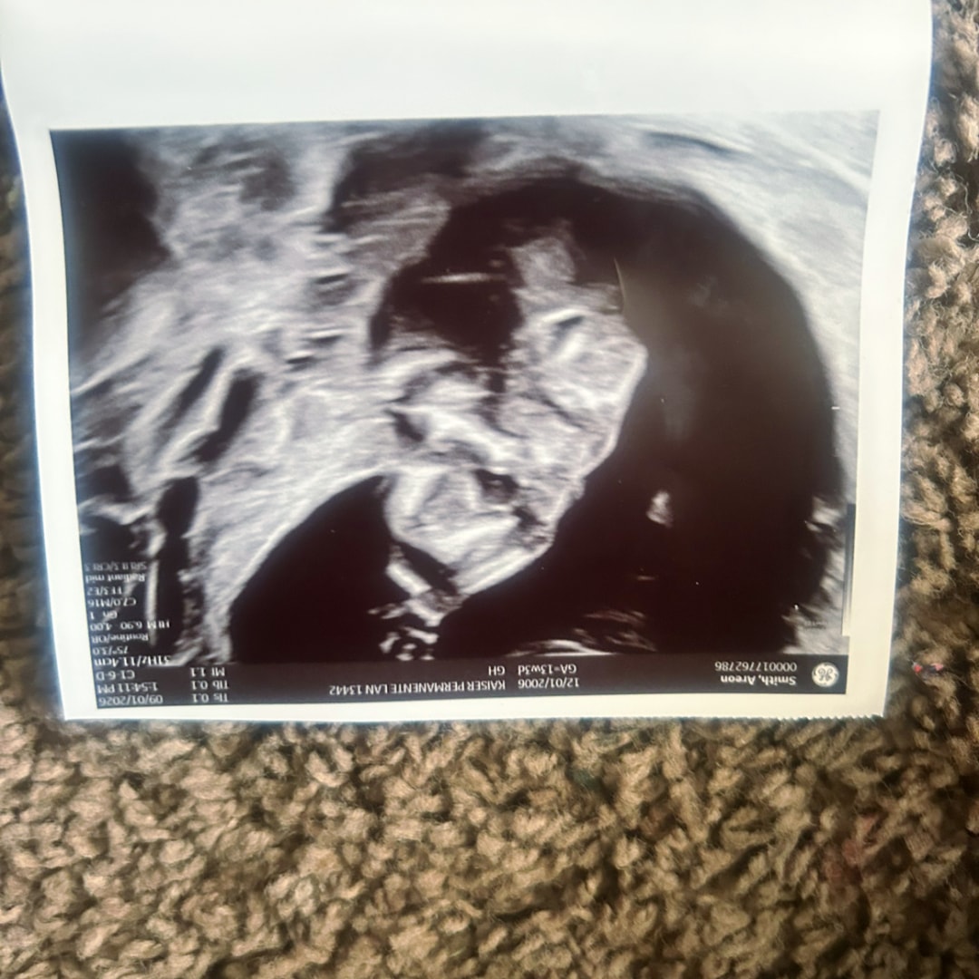 Photo shared by Exavier for their Babylist baby registry.