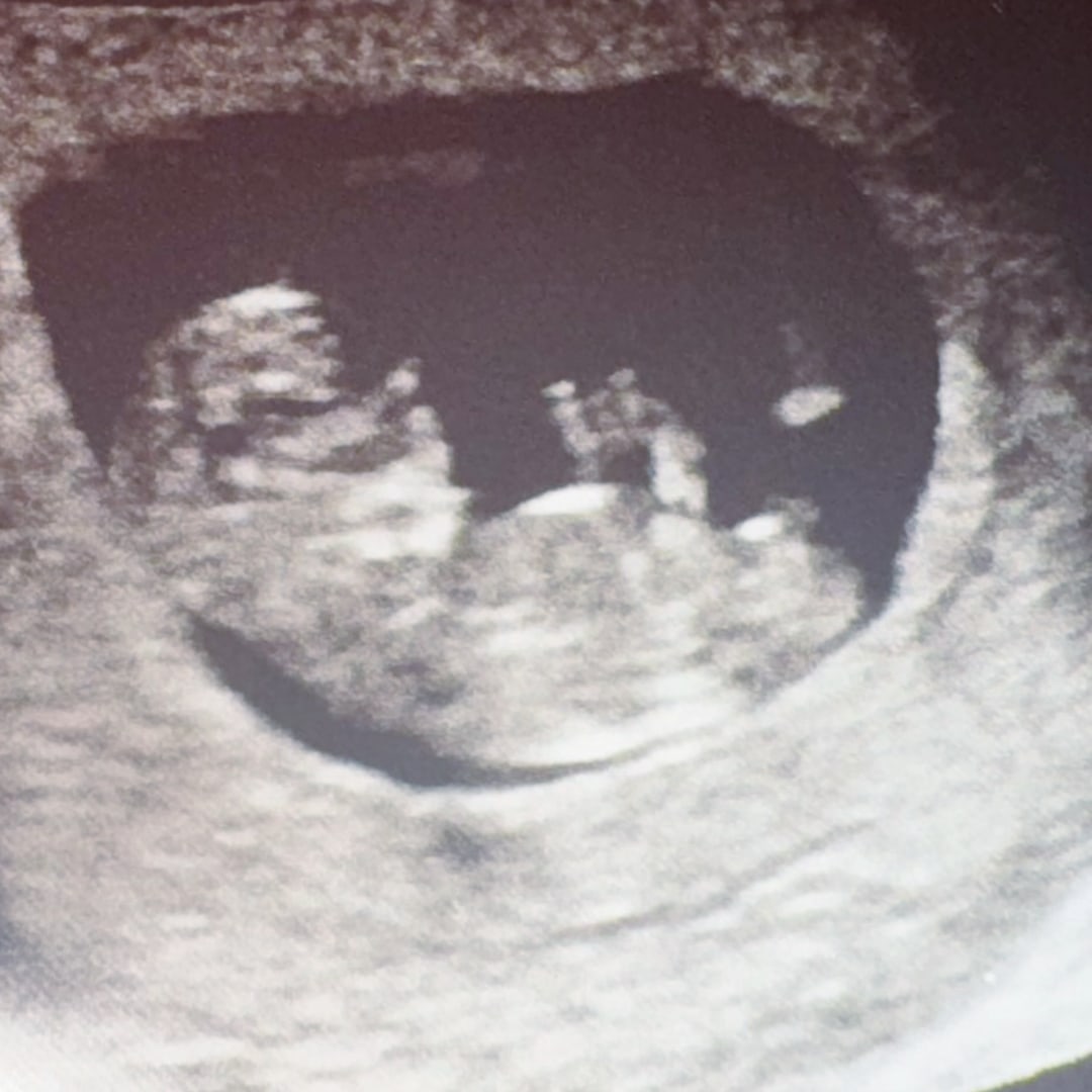 Photo shared by Kevin for their Babylist baby registry.