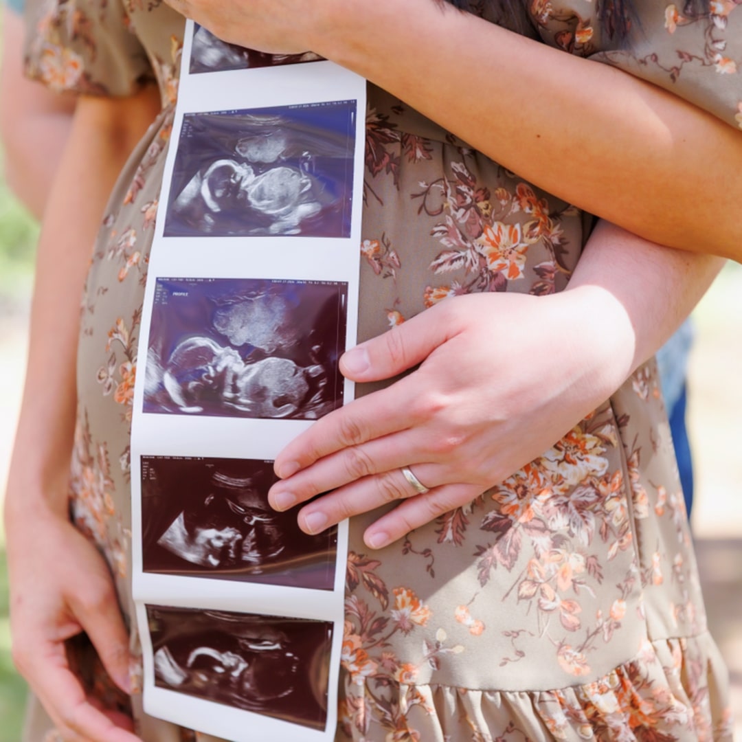 Photo shared by Milc for their Babylist baby registry.