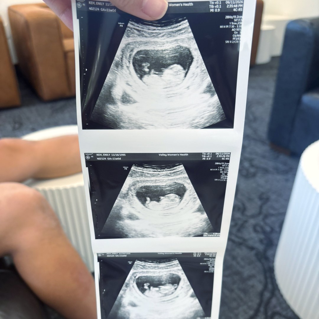Photo shared by Emily for their Babylist baby registry.