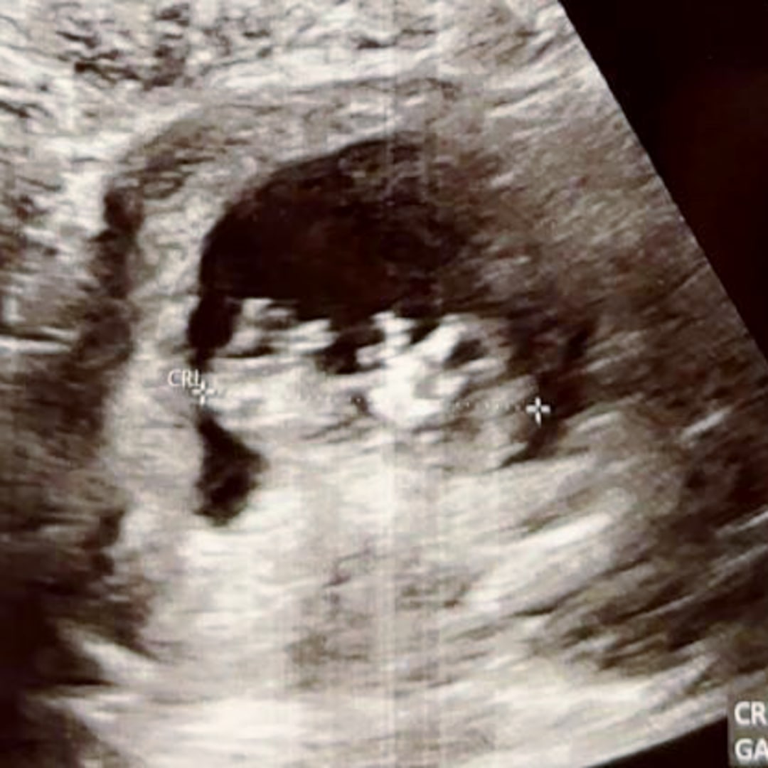Photo shared by Anna for their Babylist baby registry.