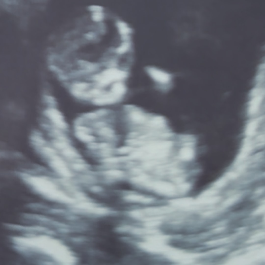 Photo shared by Dyemond for their Babylist baby registry.